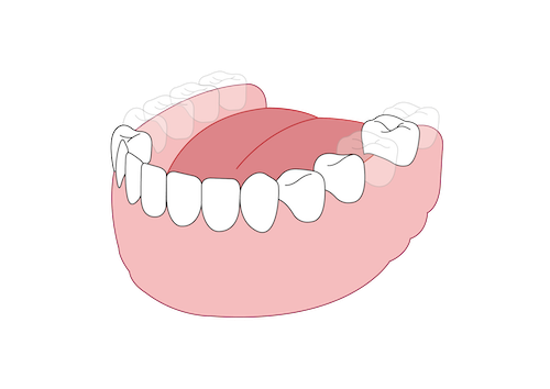 Dental Arch
